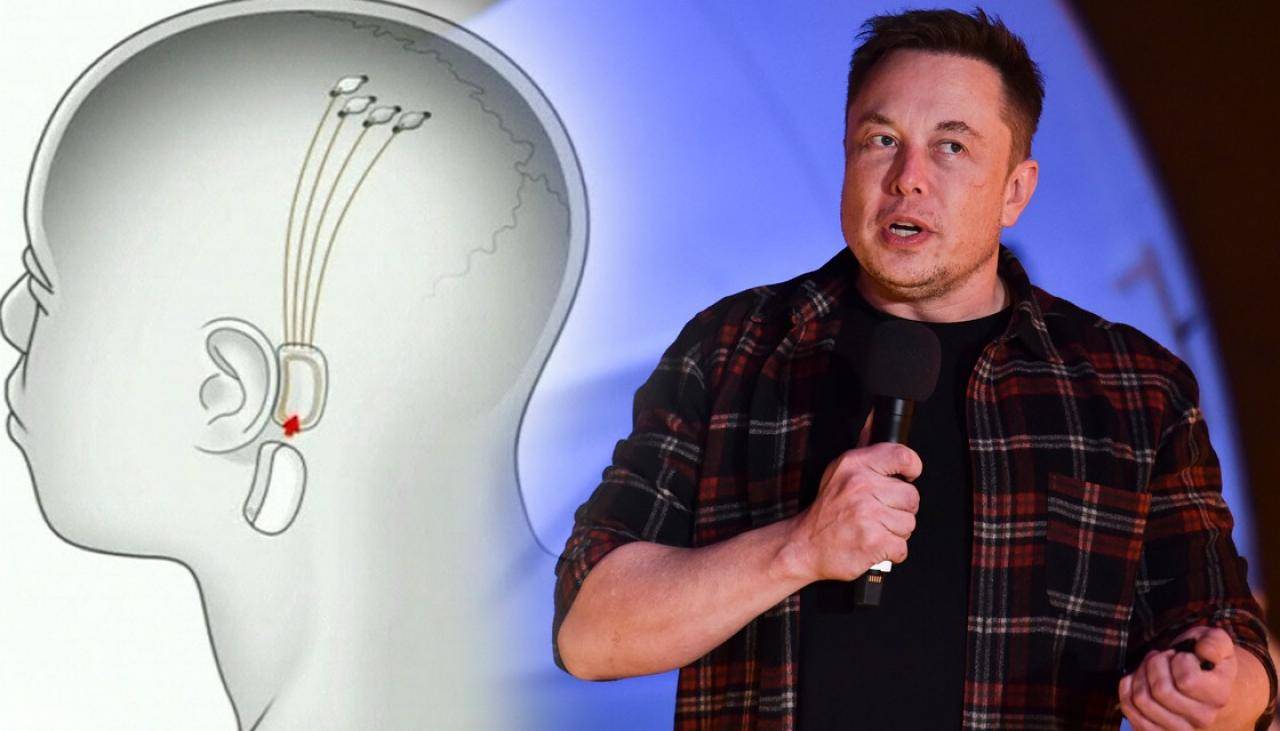 Elon Musk Neuralink